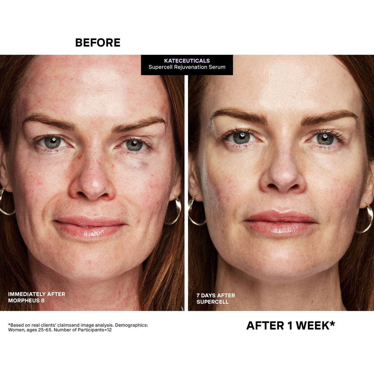 Kate Somerville KateCeuticals® SuperCell Rejuvenation Peptide Serum