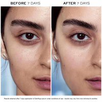 Thumbnail for Lancôme Advanced Génifique Radiance Boosting Anti-Aging Face Serum - Visibly Hydrates & Plumps Skin - with Bifidus Prebiotic, Hyaluronic Acid & Vitamin Cg, 1 Fl Oz