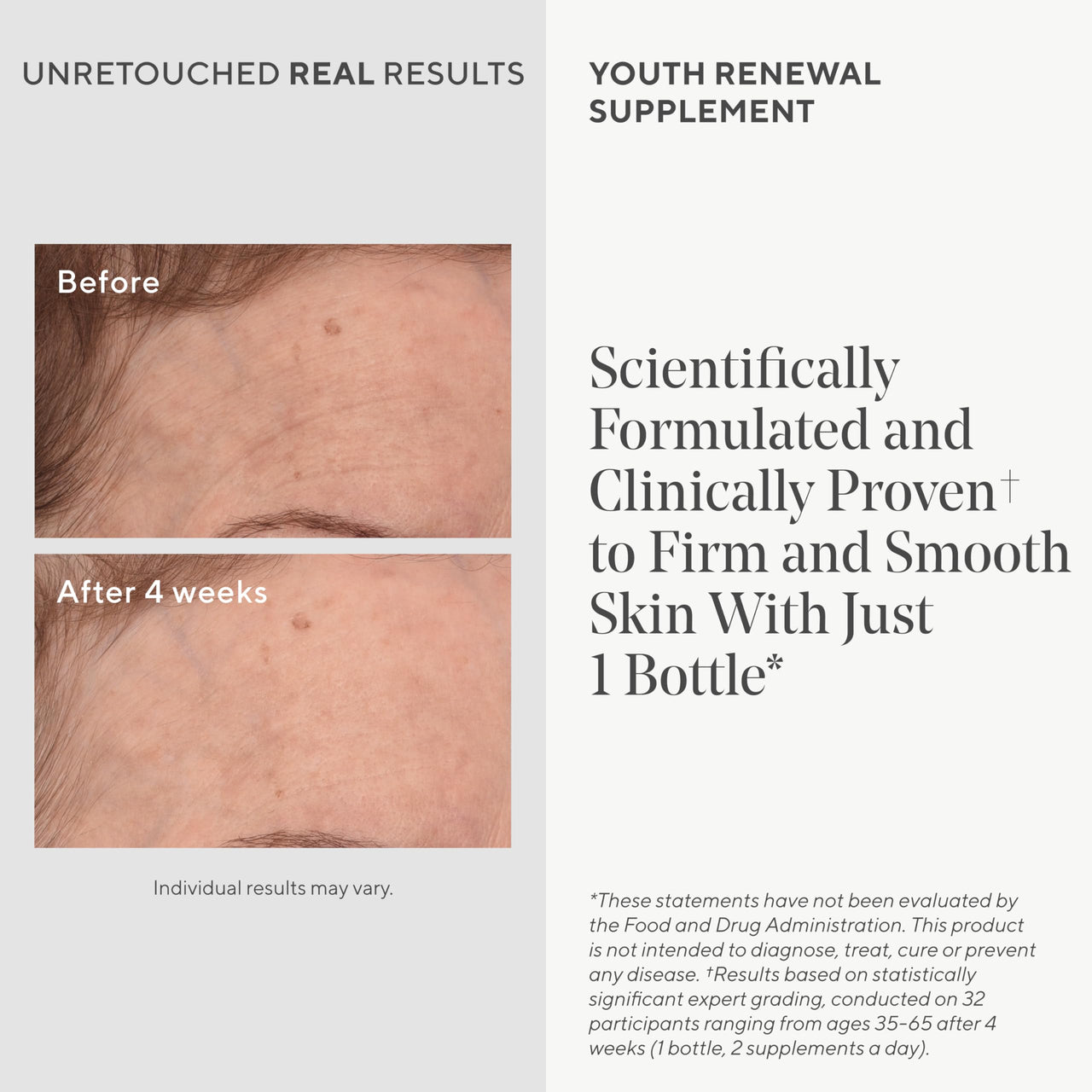 Murad Youth Renewal Supplement for Smooth, Plump Skin – Anti-Aging Beauty Supplement - Collagen and Ceramides Reduce Wrinkles and Fine Lines from Within, 28 Capsules - 14-Day Supply
