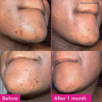 Thumbnail for Good Molecules Brightening & Dark Spots Bar - Soap Free Face and Body Bar - Tranexamic, Kojic Acids and Niacinamide to Target Dark Spots - Skin Care