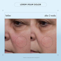 Thumbnail for philosophy renewed hope in a jar smooth-glow moisturizer 2 fl oz