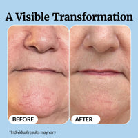 Thumbnail for Vibriance Super C Serum for Mature Skin - All-in-One Vitamin Formula Hydrates, Firms, Lifts, Smooths, Targets Age Spots, Wrinkles, 1 fl oz