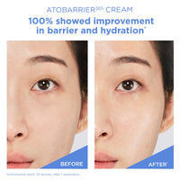 Thumbnail for AESTURA ATOBARRIER365 Cream with Ceramides, Korean Moisturizer for Skin Barrier Repair | Long-lasting Hydration, Ceramide Capsules, Dry & Sensitive Skin, Non-comedogenic, 80 mL / 2.70 fl.oz.