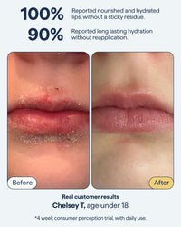 Thumbnail for Remedy for Dry Lips | All-In-One Lip Treatment | Hydrating and Healing Lip Balm Ointment with Ceramides, Peptides, and Dimethicone | Repairs Dry, Cracked Lips | By Dermatologist Dr. Shah