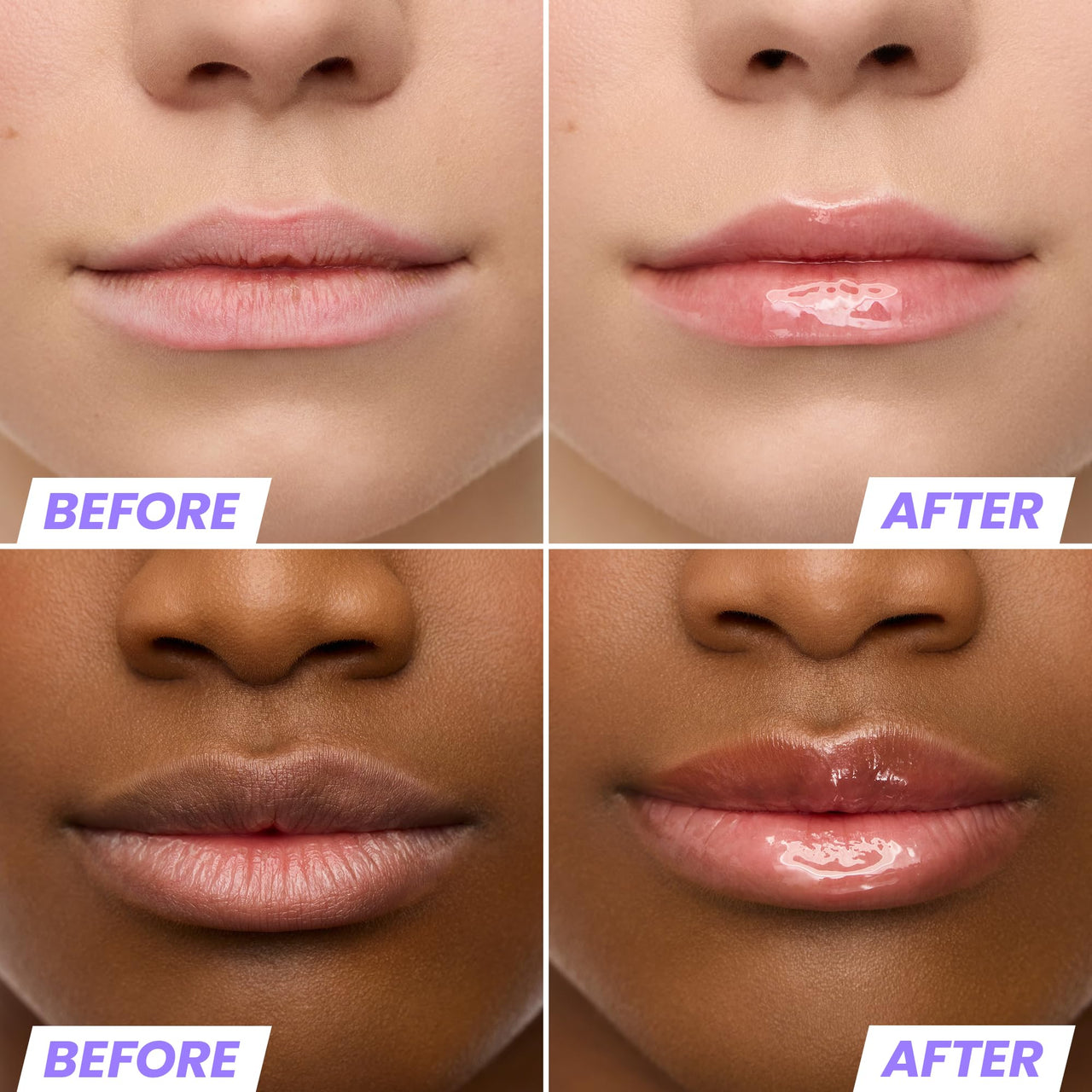 Wonderskin Lip Rehab Serum Oil - Tinted Lip Oil, Hydrating, Moisturizing, and Non-Sticky Coral Pink Tint Serum for Dry Lips (Lover)