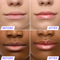 Thumbnail for Wonderskin Lip Rehab Serum Oil - Tinted Lip Oil, Hydrating, Moisturizing, and Non-Sticky Coral Pink Tint Serum for Dry Lips (Lover)