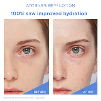Thumbnail for AESTURA ATOBARRIER365 Lightweight Korean Face Moisturizer with Ceramides | Strengthens Barrier, Fast-Absorbing Hydration, Suitable for Dry, Normal & Sensitive Skin, 90ML / 3.04 fl. Oz.