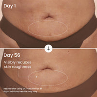 Thumbnail for MAËLYS GET-DREAMY Overnight Toning Whip - Cellulite Cream & Skin Tightening Support with Milk Thistle + Uva-Ursi - Moisturizing Body Cream in a Whipped Texture (6.8 Fl Oz)