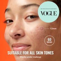 Thumbnail for Good Molecules Pimple Patches for Face, 60 Pack – Ultra-Thin Hydrocolloid Acne & Zit Patches, Invisible Under Makeup, Clinically Tested Acne Spot Treatment