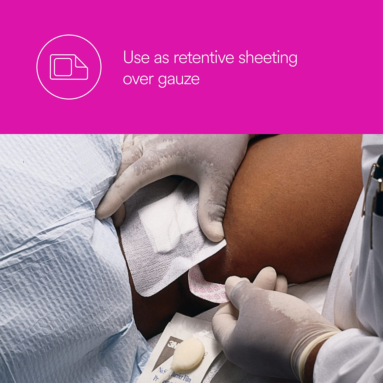 3M™ Medipore™ Dress-It Pre-Cut Dressing Covers 2957, 5 7/8 inch x 11 inch (15cm x 28cm), 3 sheets/pad, 25 pads/box