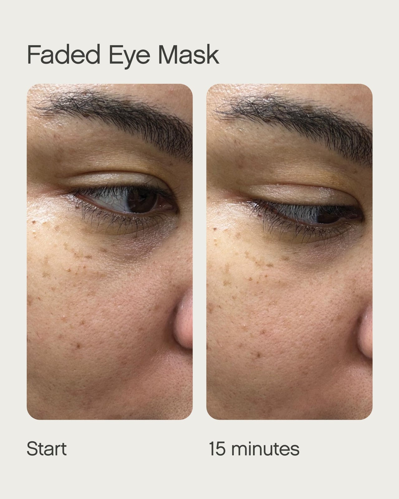 Dark circles, sun damage and pigmented skin? Get Faded Under Eye Masks + Faded Serum – a starter pack to experience our best-selling Faded formula for brightening and evening skin tone. Faded Eye Masks harness the same skin-brightening and evening ingredi