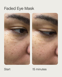Thumbnail for Dark circles, sun damage and pigmented skin? Get Faded Under Eye Masks + Faded Serum – a starter pack to experience our best-selling Faded formula for brightening and evening skin tone. Faded Eye Masks harness the same skin-brightening and evening ingredi