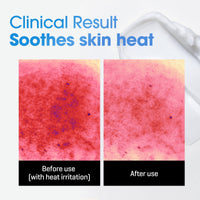Thumbnail for SOME BY MI Beta-Panthenol Repair Body Cream - 6.76Oz, 200ml - Hydrating and Redness-Soothing Daily Korean Panthenol Body Lotion - Rebuilds Body Skin Barrier for Sensitive Skin - Korean Skin Care