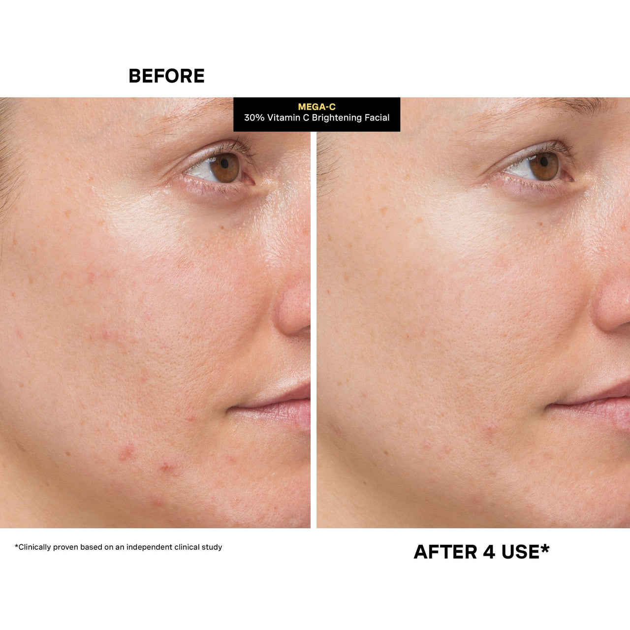 Kate Somerville Mega-C 30% Vitamin C Brightening Facial - Powerhouse Clinic-Grade Brightening Mask, 2 Fl Oz