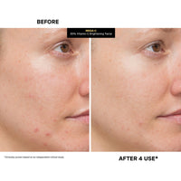 Thumbnail for Kate Somerville Mega-C 30% Vitamin C Brightening Facial - Powerhouse Clinic-Grade Brightening Mask, 2 Fl Oz