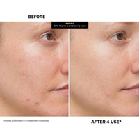 Thumbnail for Kate Somerville Mega-C 30% Vitamin C Brightening Facial Mask – Clinic-Grade Treatment to Brighten, Even Skin Tone & Firm, 2 Fl Oz