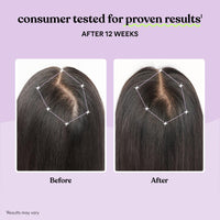 Thumbnail for Lemme Grow Hair Growth Supplement for Women, Clinically Proven Keratin Complex for Visibly Thicker Hair and Scalp Coverage, Reduced Shedding, Nourish Thinning Hair - 1 Month Supply