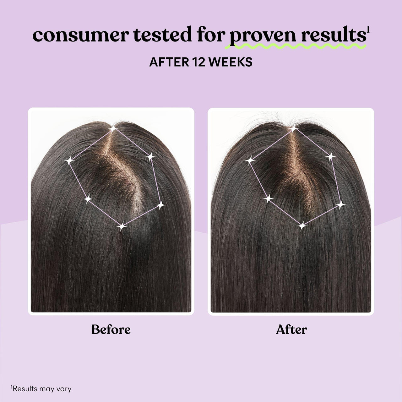 Lemme Grow Hair Growth Supplement for Women, Clinically Proven Keratin Complex for Visibly Thicker Hair and Scalp Coverage, Reduced Shedding, Nourish Thinning Hair - 1 Month Supply