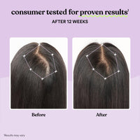 Thumbnail for Lemme Grow Hair Growth Supplement for Women, Clinically Proven Keratin Complex for Visibly Thicker Hair and Scalp Coverage, Reduced Shedding, Nourish Thinning Hair - 1 Month Supply