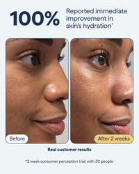 Thumbnail for Remedy for Rich Moisture | Barrier Repairing Rich Cream Moisturizer for Normal to Dry Skin | Quadruple Ceramide Complex, Peptides, Squalane, Glycerin | By Dermatologist Dr. Shah, 1.7 fl. oz