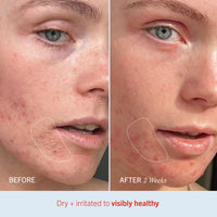 Thumbnail for First Aid Beauty - Ultra Repair Cream, Intense Hydration Whipped Colloidal Oatmeal, Clinically Proven to Strengthen Skin Barrier in 7 Days & Helps Relieve Eczema, Luxury Face & Body Moisturizer, 6 oz