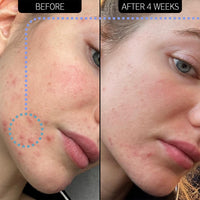 Thumbnail for The INKEY List SuperSolutions Novoretin 2% Moisturizer, Skin Clearing Moisturizer to Reduce Blemishes and Breakouts While You Sleep, Non-Comedogenic 1.69 fl oz