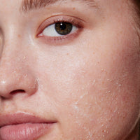 Thumbnail for e.l.f. SKIN Gentle Peeling Exfoliant, Cleanser, Effective, Easy to Apply, Peels Away Dead Skin, Removes Dirt, Ideal for All Skin Types