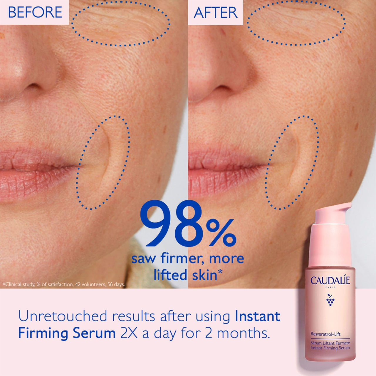 Caudalie Resveratrol-Lift Instant Firming Retinol Alternative Serum, Refill - 30 mL