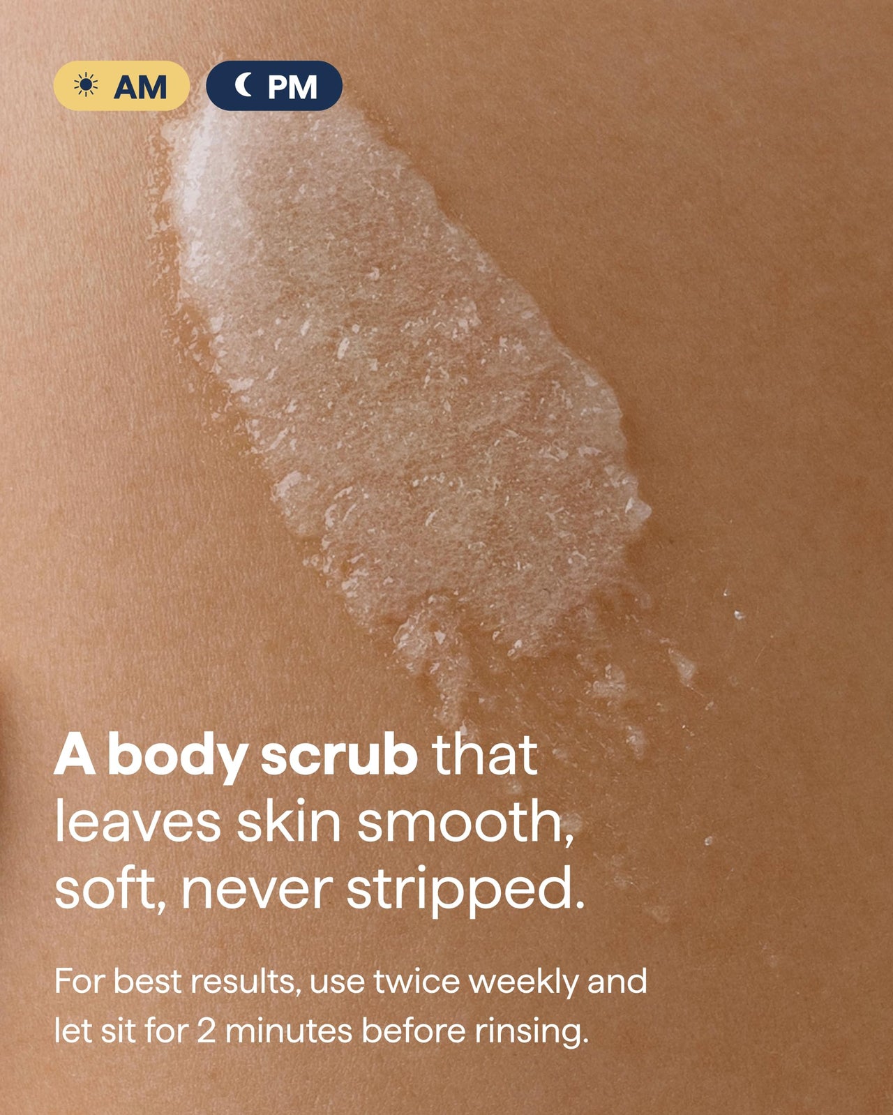Remedy KP Exfoliating Body Scrub | Keratosis Pilaris and Chicken Skin Treatment with Fine Sugar, Glycolic Acid, Lactic Acid and Squalane | Exfoliating Scrub | By Dermatologist Dr. Shah, 6.8 fl oz
