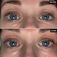 Thumbnail for The INKEY List Brighten-I Eye Cream, Under-Eye Cream Helps Reduce Appearance of Dark Circles and Boost Skin’s Glow, Makeup Under-Eye Primer, 0.50 fl oz