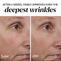 Thumbnail for Olay Face Moisturizer, Regenerist Micro-Sculpting Cream for Women, Fragrance-Free - Hydrating, Anti-Aging, Anti-Wrinkle, Firming Skin Care - Hyaluronic Acid, Niacinamide, Amino Peptides, 1.7 Oz