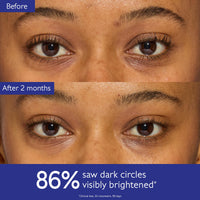 Thumbnail for Caudalie Vinoperfect Dark Circle Brightening Caffeine Eye Cream with Niacinamide, Fragrance Free - 15 mL