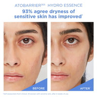 Thumbnail for AESTURA ATOBARRIER365 Hydro Essence with Hydrating Amino Acids | Lightweight Formula, Deep Hydration, Suitable for Dry & Sensitive Skin, Non-Comedogenic, 200ML / 6.76 fl. oz.