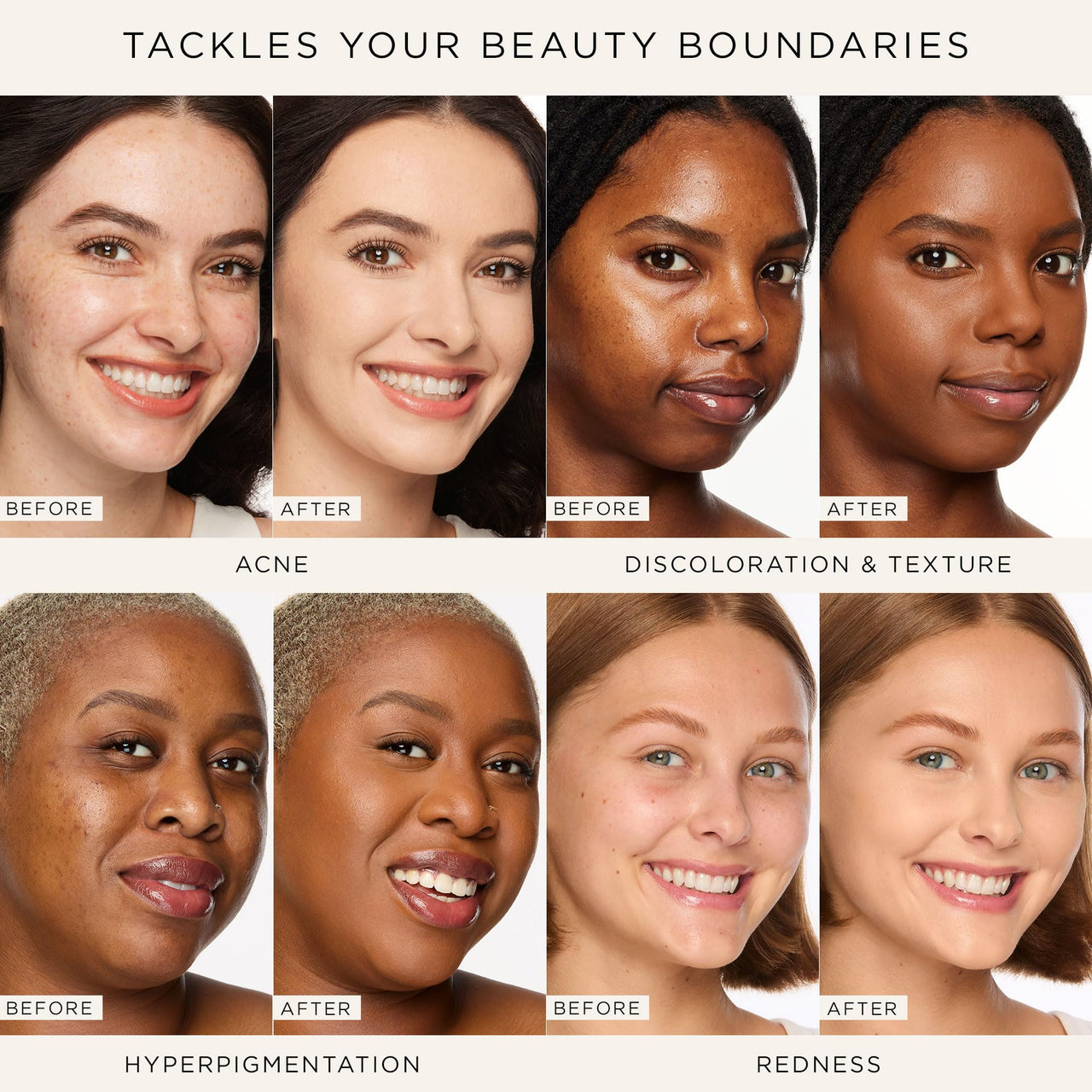 tarte shape tape concealer – Full-Coverage Creaseless Soft Matte Finish, Brightening Under-Eye & Face Makeup, 16hr Longwear, Vegan & Cruelty-Free, full size, 35H medium honey