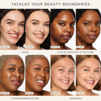 Thumbnail for tarte shape tape concealer – Full-Coverage Creaseless Soft Matte Finish, Brightening Under-Eye & Face Makeup, 16hr Longwear, Vegan & Cruelty-Free, full size, 35H medium honey