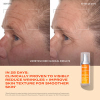 Thumbnail for Murad Rapid Dark Spot Correcting Serum - Advanced Anti-Aging Formula with Patented Resorcinol Technology, Tranexamic and Glycolic Acids for Hyperpigmentation, Dark Spots and Dull Skin - 1 Fl Oz