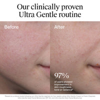 Thumbnail for Neutrogena Fragrance Free Daily Facial Moisturizer, Face & Neck Moisturizer for Sensitive Skin with Vitamin B3, Pro-Vitamin B5 & Vitamin E Supports Skin's Dynamic Barrier, 3.4 fl. oz