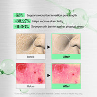 Thumbnail for VT COSMETICS CICA Reedle Shot 100, Spicule Microneedling Serum for Pore Care & Exfoliation, Exosome, Centella Asiatica for Glass Skin, Skin Texture, Korean Liquid Skin Booster (1.69 Fl Oz / 50ml)