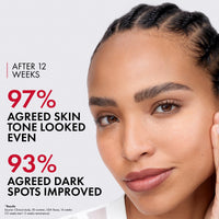 Thumbnail for Vichy LiftActiv B3 Serum, 8% Niacinamide + Melasyl + Glycolic Acid, Anti-Aging Dark Spot Corrector for Uneven Skin Tone, Lightweight Face Serum for Women & Men, Non-Sticky