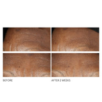 Thumbnail for Dr Dennis Gross Advanced Retinol + Ferulic Intense Wrinkle Cream | Intensely Hydrating to Visibly Transform Skin and Repair the Moisture Barrier | 2 oz