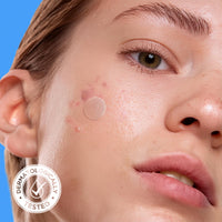 Thumbnail for AVARELLE Acne Cover Patches, Eligible Hydrocolloid Pimple Patches for Face with Tea Tree Oil, Korean Skincare Zit Patches for Face | HSA Store Eligible Items | Vegan, Cruelty-free