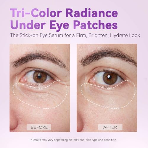 Image 6 of AILEORY Under Eye Patches (24 Pairs)