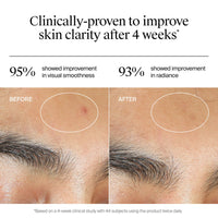 Thumbnail for Neutrogena Evenly Clear Acne Gel Moisturizer with Salicylic Acid & N-Acetyl Glucosamine, Lightweight Non-Greasy Face Moisturizer Helps Treat Breakouts & Visibly Fade the look of Post-Acne, 1.7 fl. oz