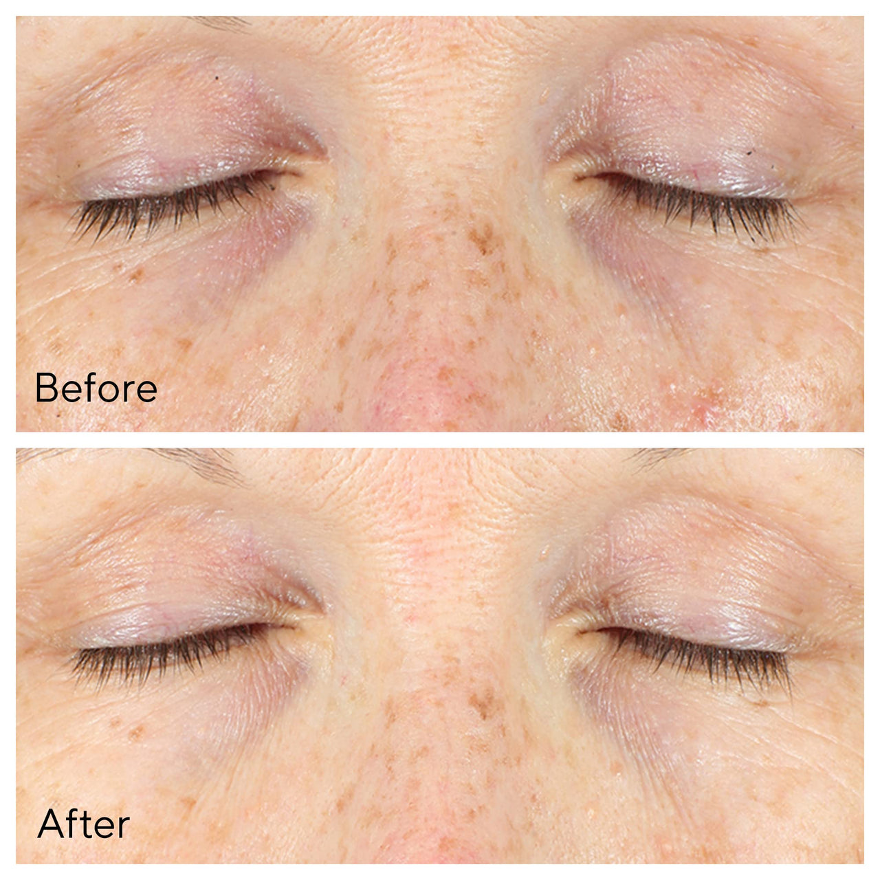 Murad Vita-C Eyes Dark Circle Corrector – Environmental Shield Vitamin C Brightening Serum – Anti-Aging Treatment for Puffiness and Wrinkles, 0.5 Fl Oz