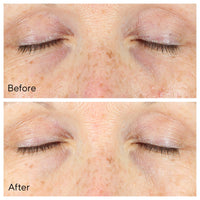 Thumbnail for Murad Vita-C Eyes Dark Circle Corrector – Environmental Shield Vitamin C Brightening Serum – Anti-Aging Treatment for Puffiness and Wrinkles, 0.5 Fl Oz