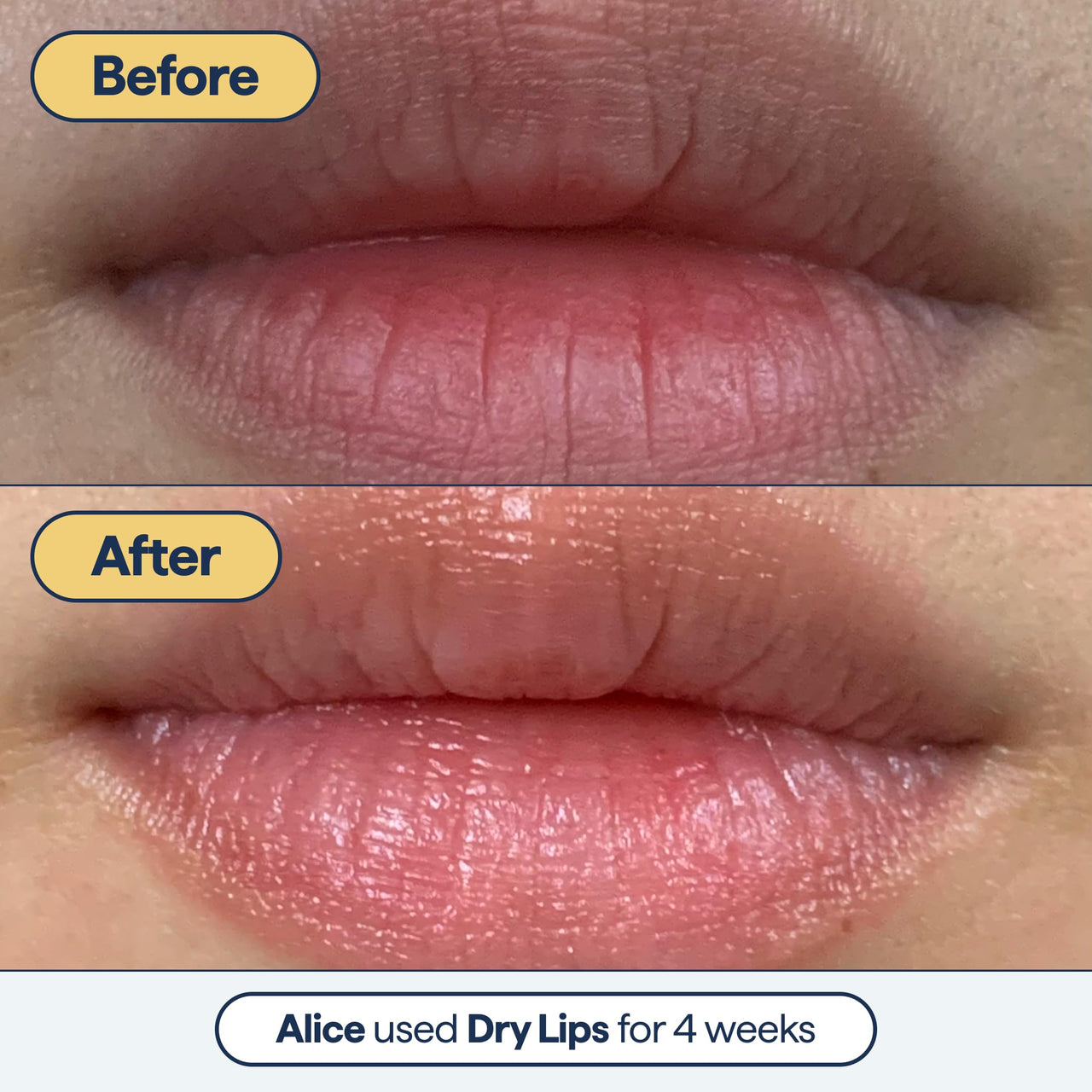 Dr. Shah's Dermatologist Bundle: 2x Remedy for Healthy Aging | Retinaldehyde, Argireline, Matrixyl 3000 & Glycolic Acid for Wrinkles + 1x Remedy for Dry Lips | Ceramides & Peptides for Cracked Lips