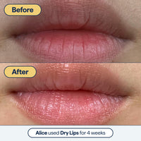 Thumbnail for Dr. Shah's Dermatologist Bundle: 2x Remedy for Healthy Aging | Retinaldehyde, Argireline, Matrixyl 3000 & Glycolic Acid for Wrinkles + 1x Remedy for Dry Lips | Ceramides & Peptides for Cracked Lips