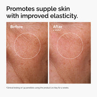 Thumbnail for The Ordinary Hyaluronic Acid 2% + B5 (with Ceramides), Multi-Depth Hydration Serum for Plumper, Smoother Skin, 1 Fl Oz