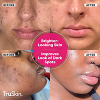 Thumbnail for TruSkin Vitamin C Super Serum - Niacinamide, Retinol, Hyaluronic & Salicylic Acid - All-in-One Anti Aging Serum for Face – Improve Appearance of Dark Spots, Firmness for Brighter Looking Skin, 2 Fl Oz