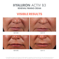 Thumbnail for Avène Hyaluron Activ B3 Renewal Firming Cream 1.6 Fl Oz